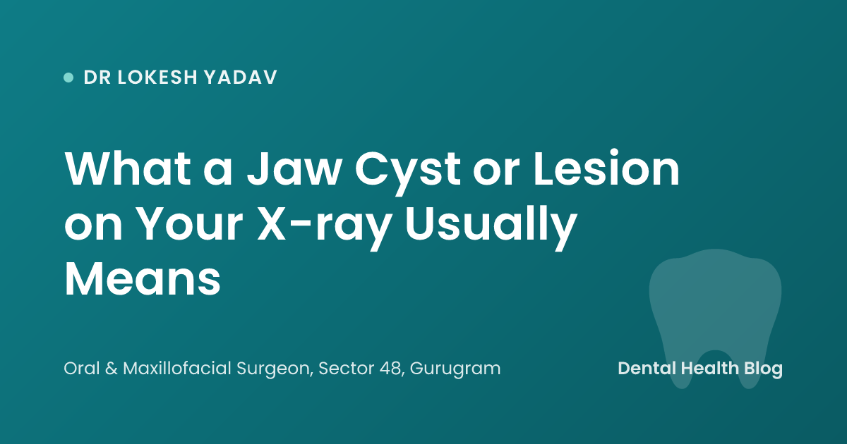 What a Jaw Cyst or Lesion on Your X-ray Usually Means