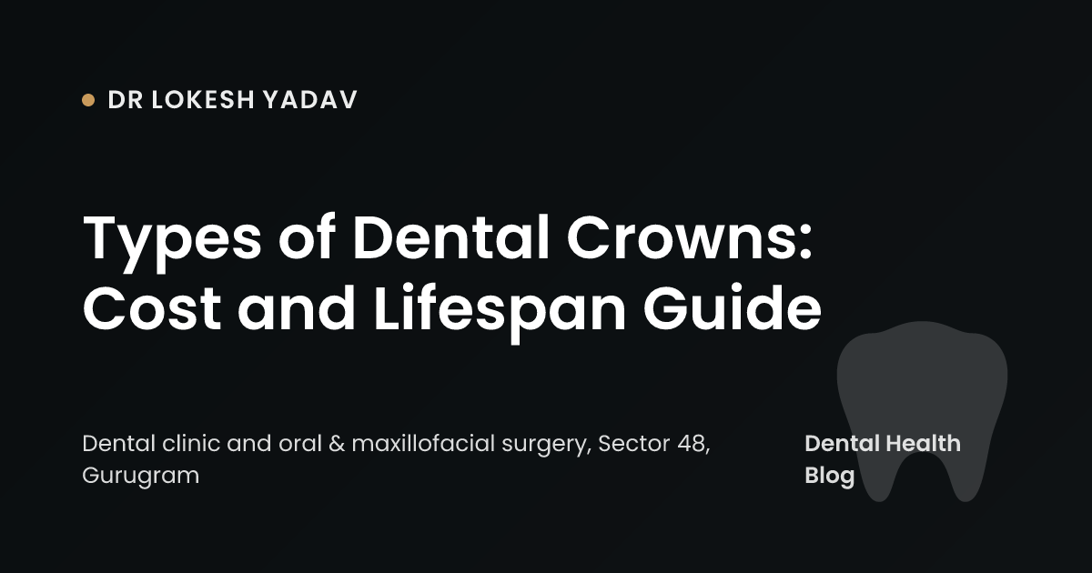Types of Dental Crowns: Cost and Lifespan Guide