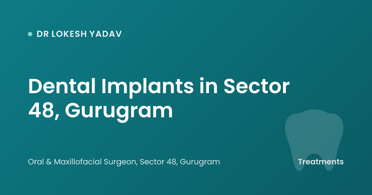 Dental Implants in Sector 48, Gurugram