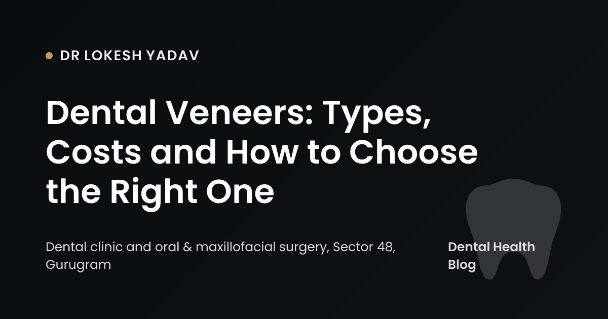 Dental Veneers: Types, Costs and How to Choose the Right One