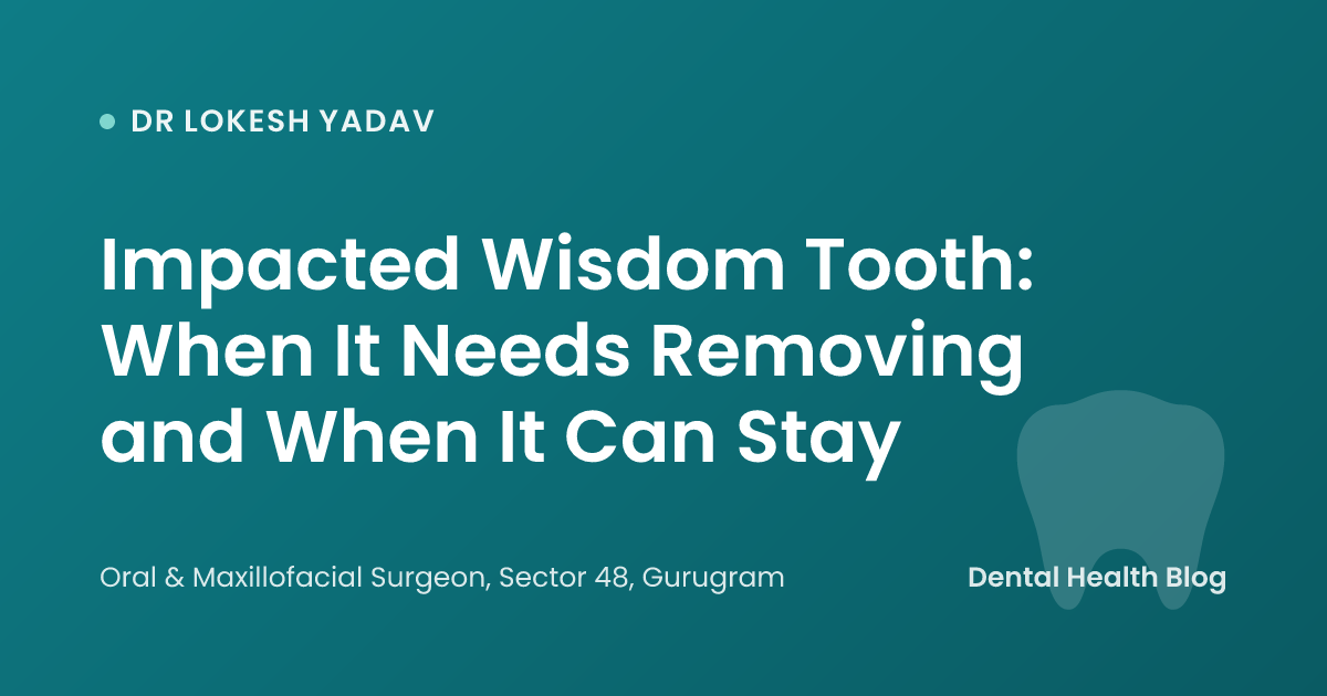 Impacted Wisdom Tooth: When It Needs Removing and When It Can Stay
