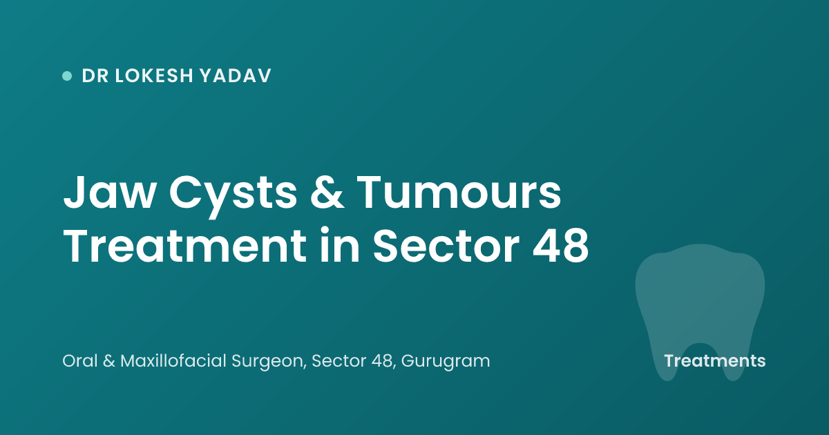 Jaw Cysts & Tumours Treatment in Sector 48