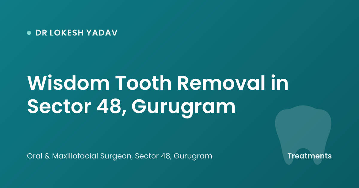 Wisdom Tooth Removal in Sector 48, Gurugram
